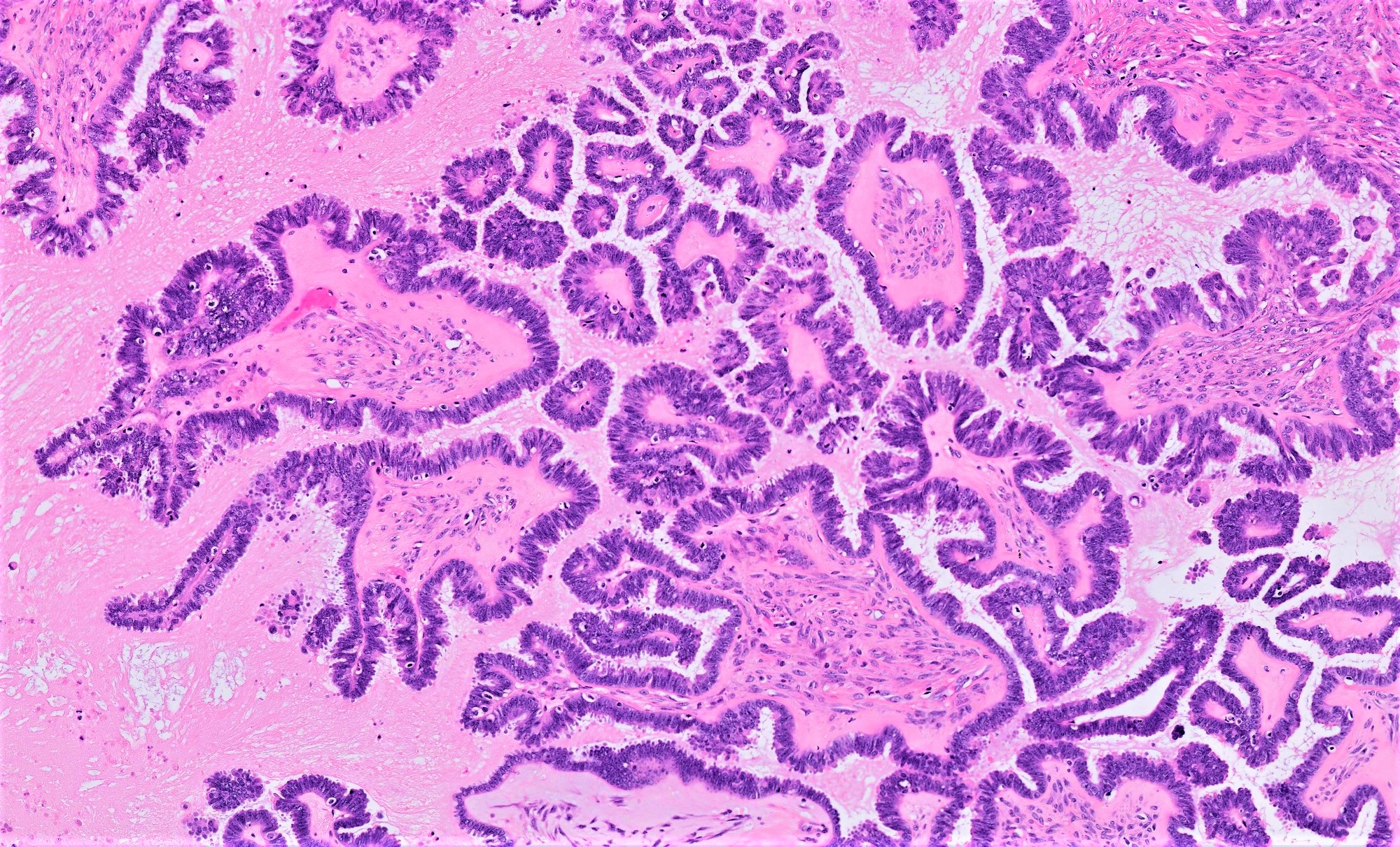 Malignant indications
